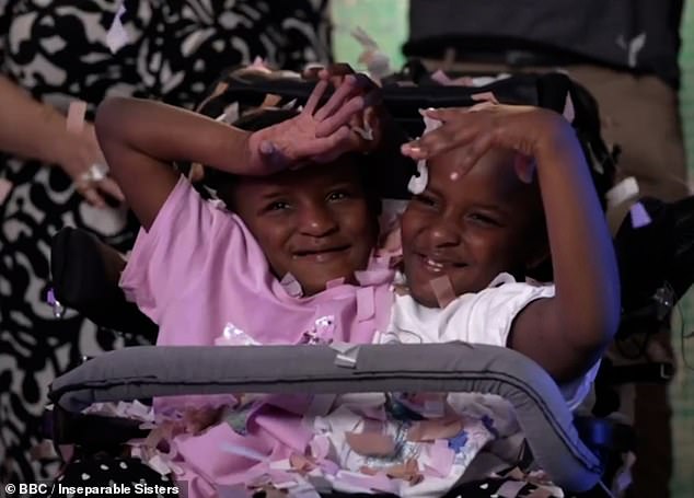 Siamese twins Marieme and Ndeye (pictured) have separate brains, hearts and lungs, but share a liver, bladder, digestive system and three kidneys.  Dressing the girls can be difficult due to their condition, their father has revealed