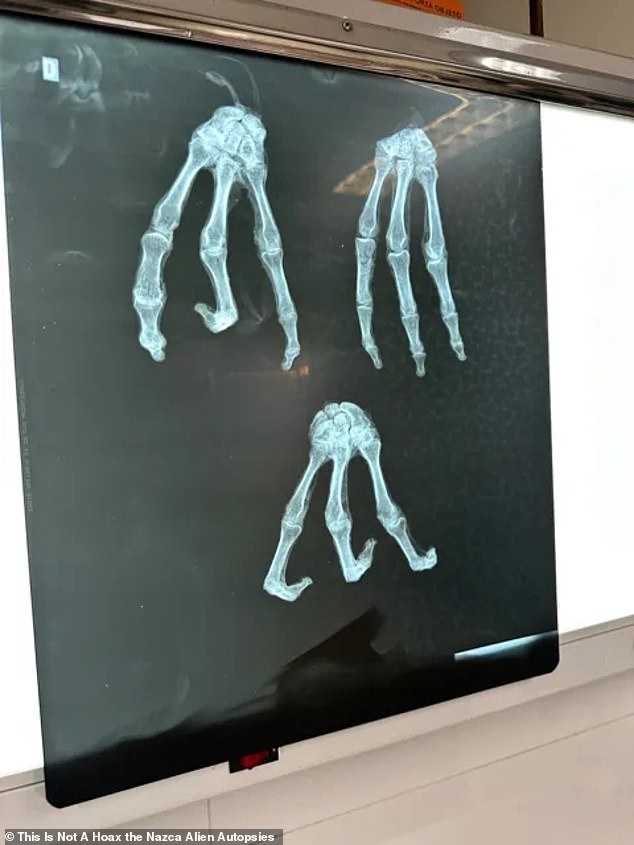 So far, the filmmaking couple reports that X-rays (above), DNA and other laboratory tests have been performed on one of the apparently mummified bodies, filmed in collaboration with scientists from the United States on location in Mexico and Peru.