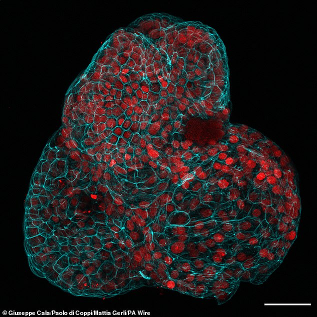 Stem cells from the lungs, kidneys and intestines were successfully extracted and used to grow organoids that had functional characteristics of these tissue types.  In the photo: the mini lung