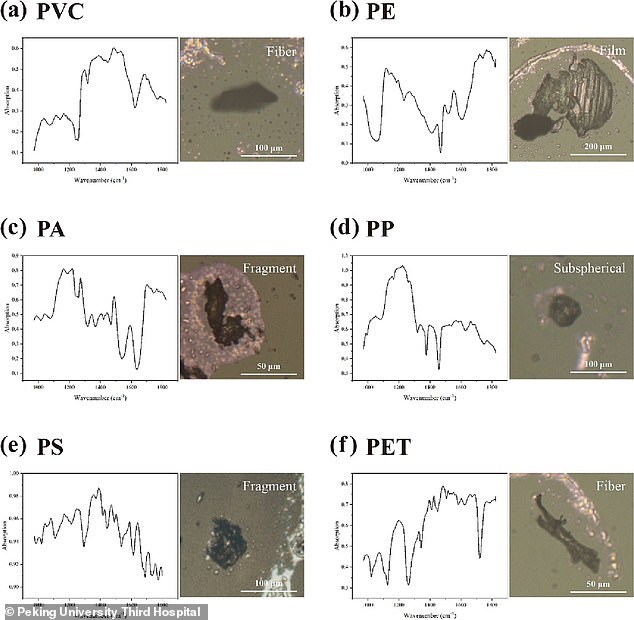 The majority of particles in the testis were polystyrene (PS, 68%), while polyethylene (PE) and polyvinyl chloride (PVC) were the main types in semen.