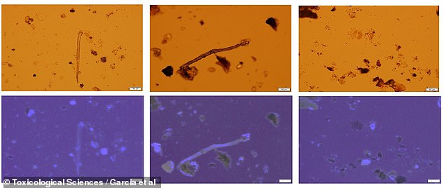 These light microscope images show microplastics in human placenta samples.  The bottom row is illuminated with UV light to show how much plastic is still in the sample even after the tissue has been processed