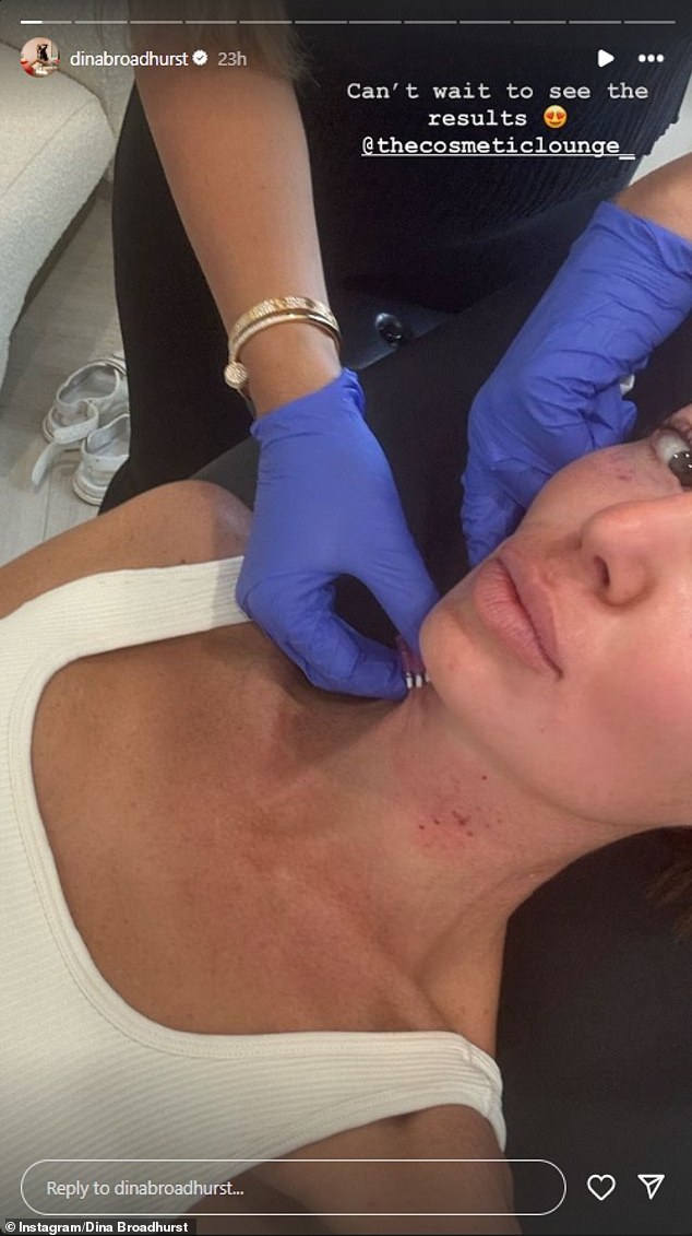 The 'nude artist', who looks ten years younger than her 46 years, shared a selfie on her Instagram Stories showing her receiving cosmetic treatment on her neck