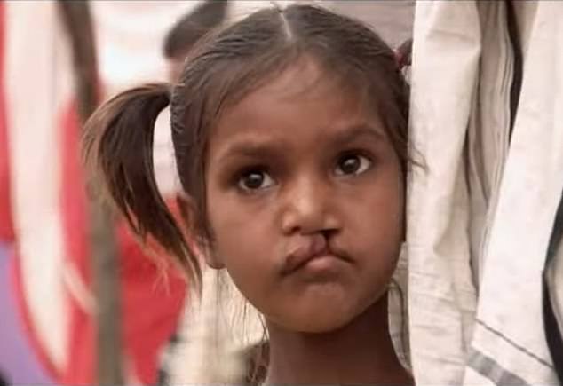 Smile Pinki told the story of the cruel abuse and taunts the little girl received for having a cleft lip - before undergoing life-changing surgery