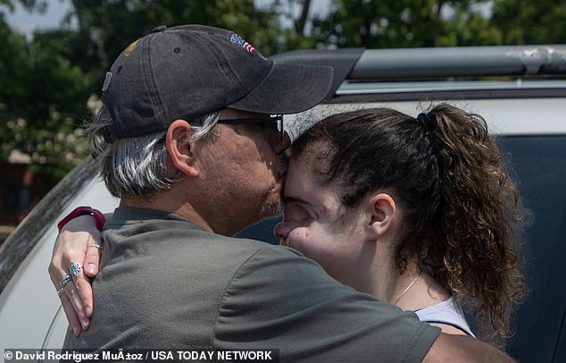 Dewey hugs her father Robert Dewey, 47, before her nose reconstruction surgery