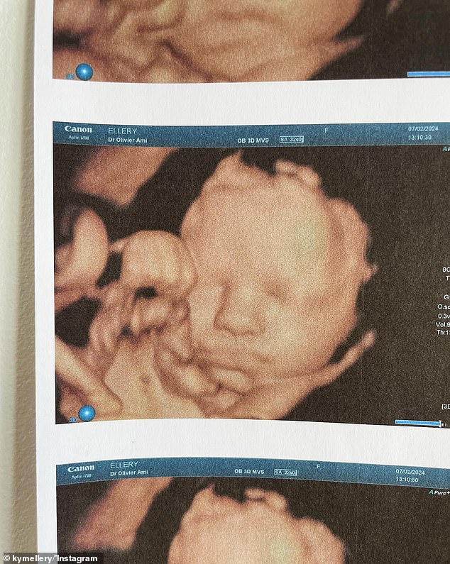 The 39-year-old revealed her growing baby bump in an Instagram post on Thursday, as she shared a series of images, including her latest ultrasound (pictured)