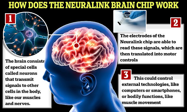 The Neuralink chip works by inserting very fine wires into parts of the brain to measure its activity.  The device then sends these signals to computers, allowing the patient to control them remotely