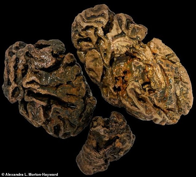 Brain fragments from a person buried in a Victorian workhouse cemetery in Bristol, UK, about 200 years ago.  No other soft tissue survived among the bones dredged from the heavily waterlogged grave.