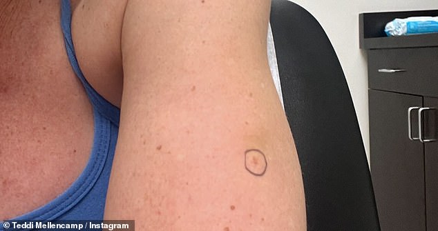 'But in full transparency, there was also one abnormal spot during my three-month check-up that the doctor thought we should biopsy, she revealed.