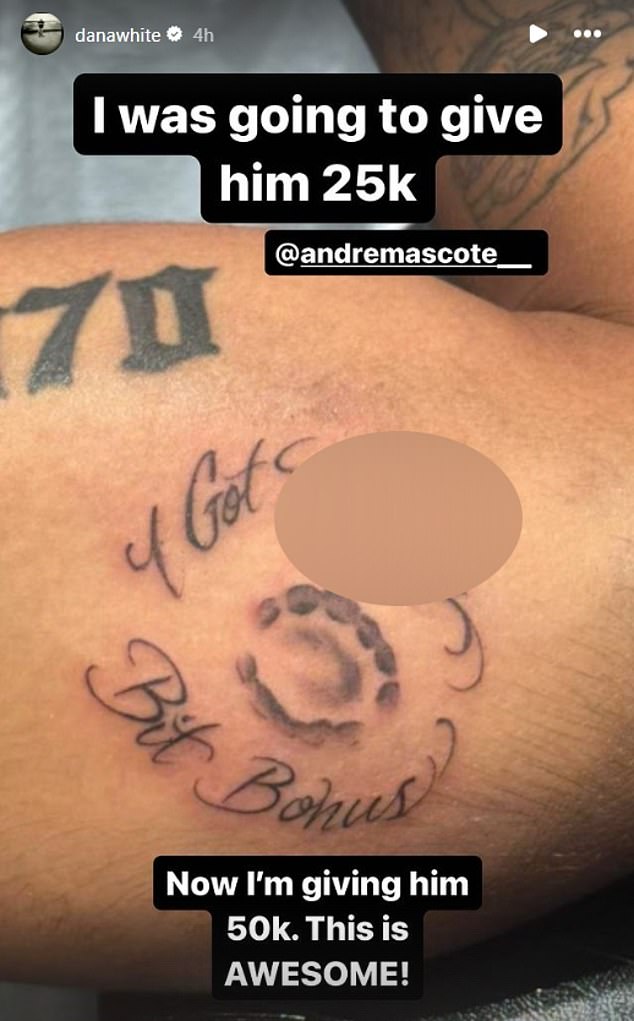 1711271529 367 Andre Lima gets TATTOO of bite marks left by UFC