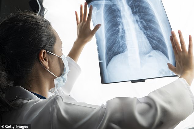 New recommendations state that people should start screening for lung cancer from the age of 50