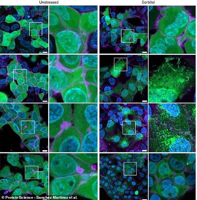 Human kidney cells treated with CAHS D (second row from top) survived stress much better than untreated cells (top row) or cells given gene therapy to be stress tolerant (bottom two rows)