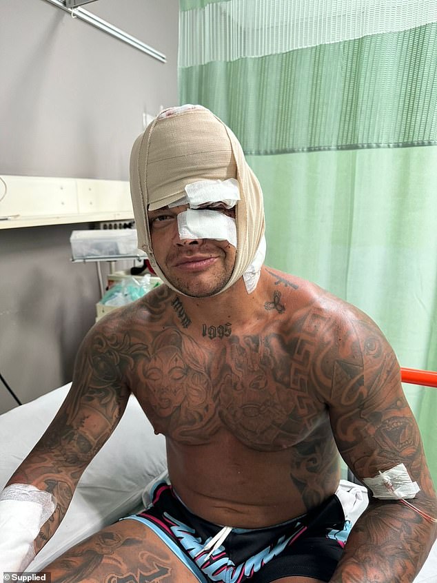 Peter Noel Sidney Nye (pictured), 28, and his friend Izaeah Wilson, both from Queensland, claim they were attacked outside a mini-mart in Kuta early on Friday morning