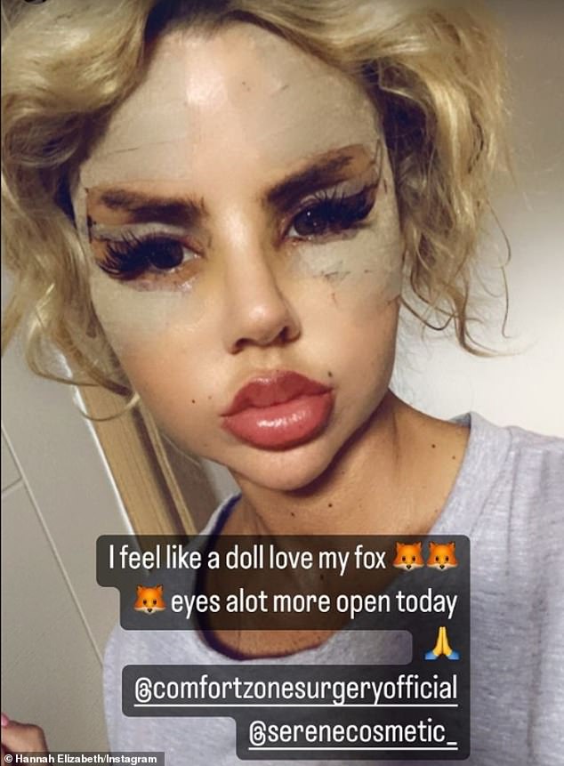 Hannah recently criticized 'jealous and bitter' trolls for their abuse following her facial surgery transformation posts