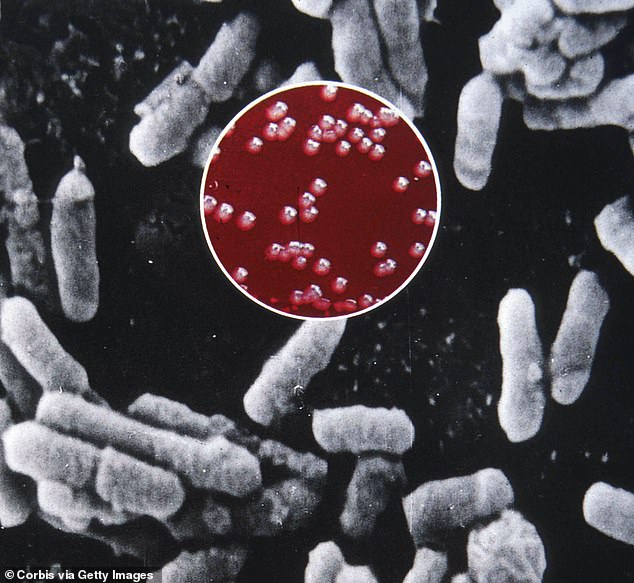 A New Mexico man became the first to die from plague in the US this year after contracting the Yesinia Pestis bacteria (photo, in red file)