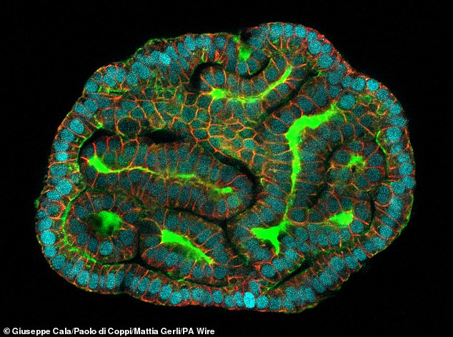 'Mini organs' have been grown for the first time from human stem cells taken during the late stages of pregnancy, marking a 'huge step forward' for prenatal medicine.  In the photo: a mini kidney