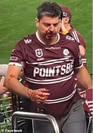 A Manly fan was left bloodied as he watched his match play in Las Vegas