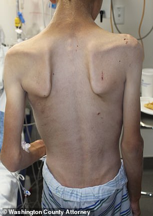 The emaciated 12-year-old boy