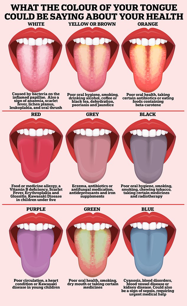 A healthy tongue should be pink, with small bumps – or papillae – over the entire surface.  However, a range of other colors can be a sign that someone is not feeling well