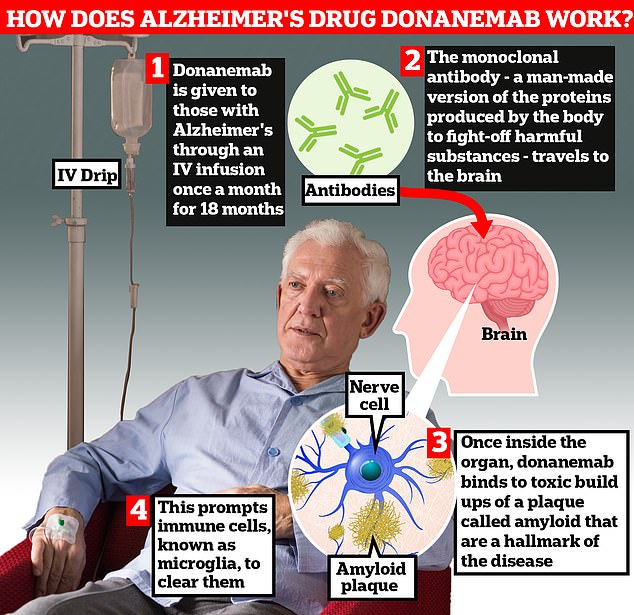 Donanemab is given to Alzheimer's patients once a month through an IV infusion.  The monoclonal antibody – a man-made version of proteins produced by the body to fight harmful substances – travels to the brain.  Once inside the organ, donanemab binds to toxic build-ups of amyloid plaque – a hallmark sign of the memory-robbing disease.  This causes immune cells known as microglia to clear them away