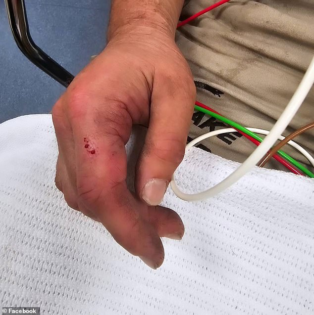 Mr Pelley was bitten on the hand and was rushed to hospital