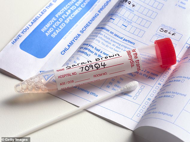 Doctors recommend starting regular STD testing as soon as you become sexually active