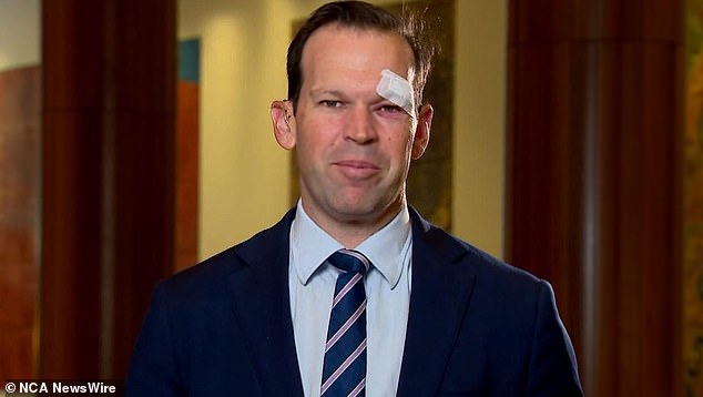 Liberal Senator Matt Canavan has shocked viewers of a morning TV show by turning up for a live interview with a bandage over his eye