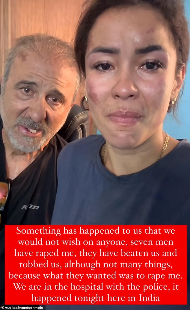 Fernanda (photo, right) and her partner Vicente (photo, left) have shared harrowing images after the Brazilian influencer was allegedly beaten and raped by several men