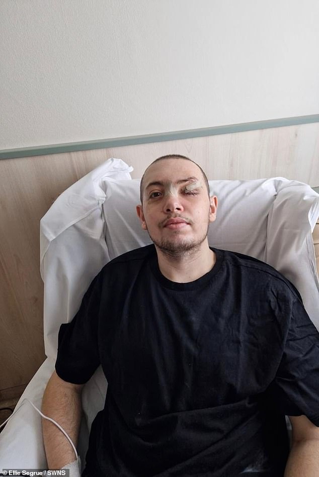 Mr. Ziv is recovering in hospital.  As soon as he got back home.  Mr. Ziv became aware of his scars.  He said: 'I didn't want anyone to look at me.  It was horrible'