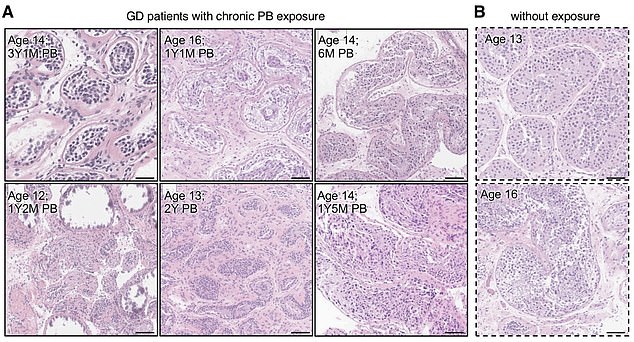 The Mayo Clinic's 33-page study revealed puberty blocker damage at the cellular level