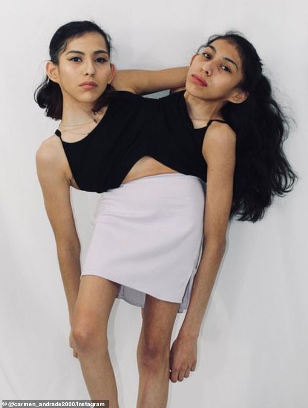 The twins are very open about their story on social media, and although they sometimes receive 'nasty comments', Carmen insists it has not brought them down