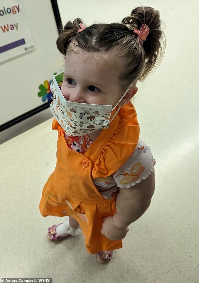 Jessi is now two years old and is still undergoing treatment for her condition.  Doctors diagnosed Kippel Trelauney Syndrome when she was eleven months old.