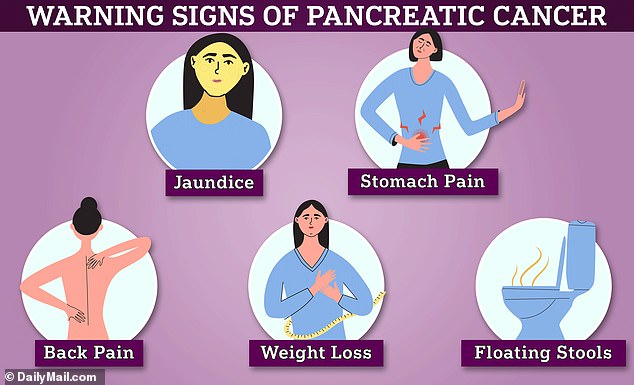 Early signs of pancreatic cancer include jaundice, stomach pain, back pain, weight loss and floating stools