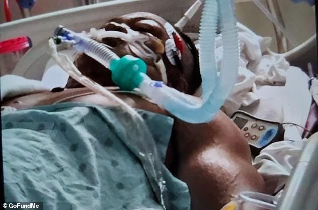 Chidozie remained on life support as his family prayed for his recovery, but he suffered a devastating spinal cord injury and died of complications 18 days later.