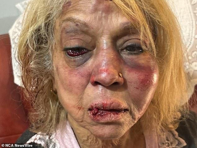 Ninette Simons (photo) was allegedly attacked, with the group holding her to the ground and punching her several times in the face, rendering her unconscious