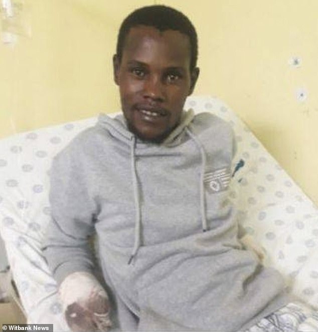 The mutilated Mahlangu had both hands cut off by a preacher after allegedly stealing from him