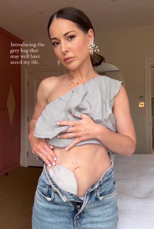 Louise Thompson has revealed how she had a colostomy bag fitted after years of suffering from ulcerative colitis, saying it 'might have saved her life'