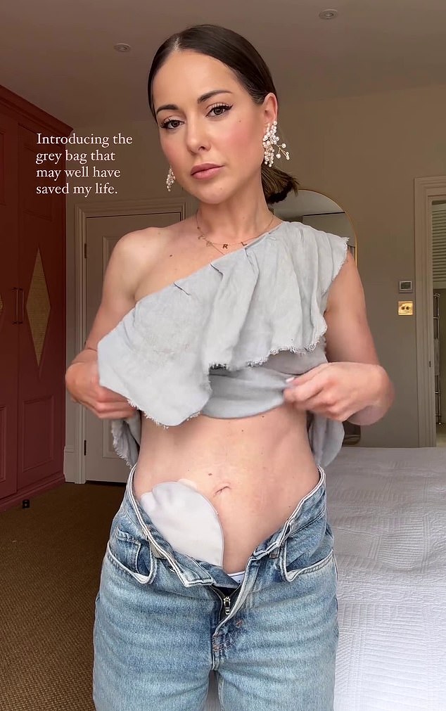 Louise shared the news that she had been fitted with a colostomy bag with her Instagram followers in early April, as she bravely admitted it was 'not something she wanted to hide forever'