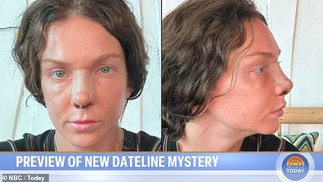 Armstrong had a nose job and brow lift in Costa Rica while on the run from authorities in Texas who issued a warrant for her arrest in 2022.