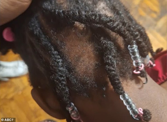 The empty spot where the braid used to be on her daughter's head was so disturbing to the mother that she called doctors to her home when Zuwena came home.