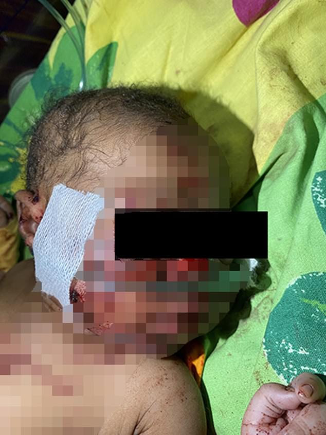 A newborn baby was buried alive by her mother in Uganda but miraculously survived underground for six hours