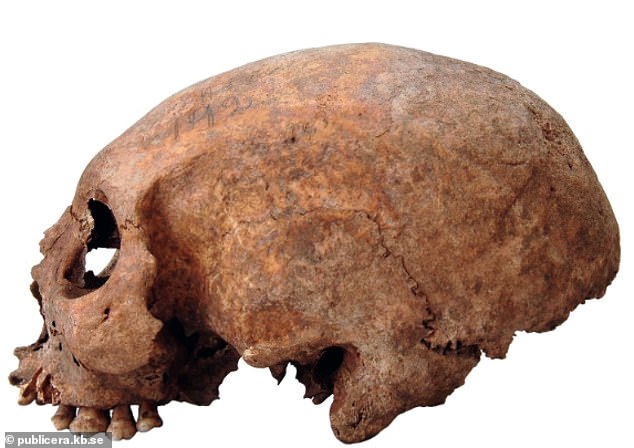 Researchers found elongated skulls of three Viking women (one skull pictured) that had been deliberately modified in the first year of their lives