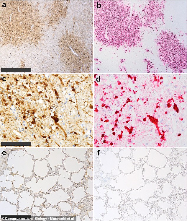 Scientists have found evidence of influenza A (H5N1) in the dead bottlenose dolphin: (a) viral antigens in the central nervous system;  (b) viral RNA in the same part of the central nervous system;  (c) virus antigen in the neurons proper;  (d) viral RNA in the same neurons;  e) traces of virus in the lungs;  and (f) negative screening for viral RNA in the lungs