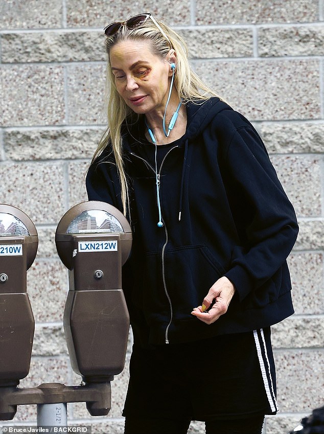 The Snake Eyes actress was spotted putting coins in a parking meter on Sunday with a black eye and fading bruises on her face