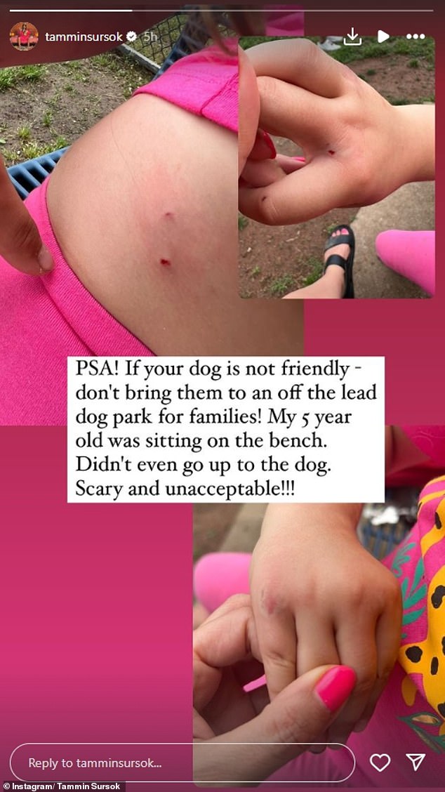 The Pretty Little Liars actress, who now lives in Nashville, shared on Instagram on Sunday the horrific injuries suffered by her five-year-old daughter Lennon after she was viciously attacked by a dog