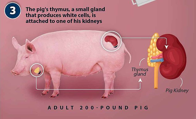 1715478573 652 Patient 62 who had worlds first successful pig kidney transplant