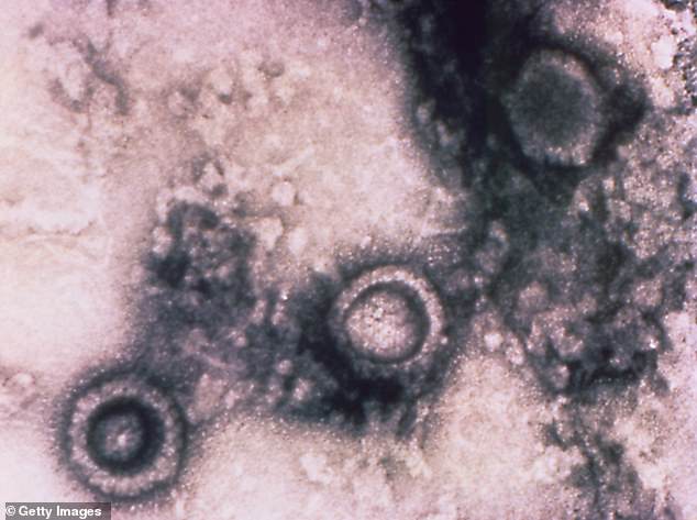 Researchers believe the herpes viruses (pictured) 'may have been a major cause of the Neanderthal extinction', but need additional testing to confirm findings