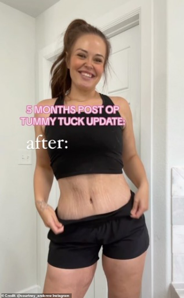 Last July, Ms Kleinebreil, who has three children, took the plunge and underwent cosmetic surgery to tighten her abdominal muscles.  Earlier this year she underwent a fat transfer breast lift to repair her 'deflated' triple D breasts, chronicling her journey on social media