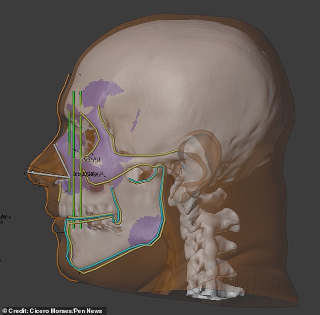 Data from living donors was used to determine the likely dimensions and position of the king's nose, ears, eyes and lips