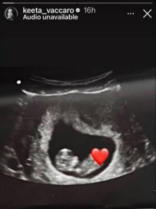 Vaccaro posted an image of an ultrasound with a child and a heart emoji on her Instagram Story