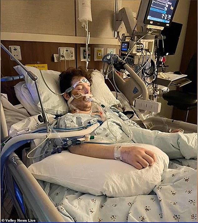 Jackson Allard, 22, was found to be suffering from influenza 4 and double pneumonia due to vaping.  To survive, he had to undergo a double lung transplant